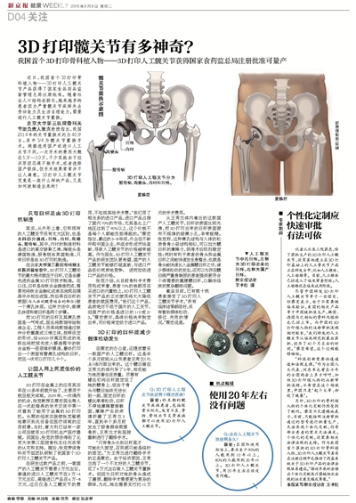 探索前沿科技，最新进展揭示3D打印髋关节的惊人进展